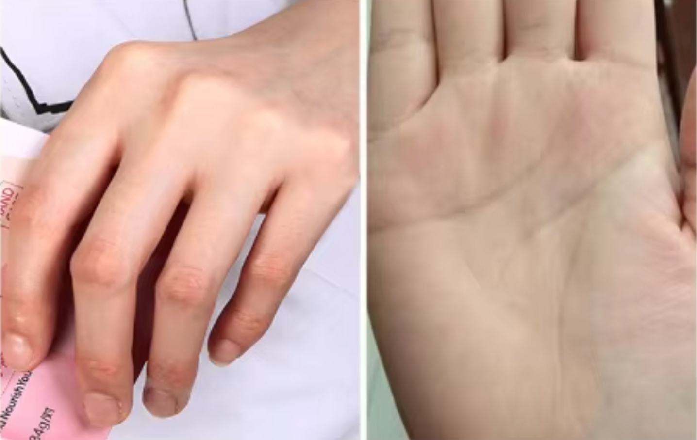 كريم الحرير العلاجي – لترميم وترطيب تشققات الجسم بزيت الحصان