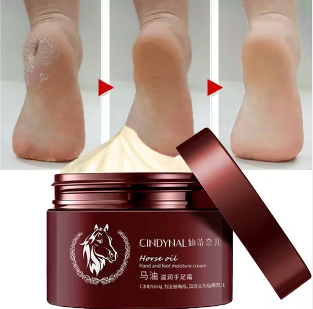 كريم الحرير العلاجي – لترميم وترطيب تشققات الجسم بزيت الحصان