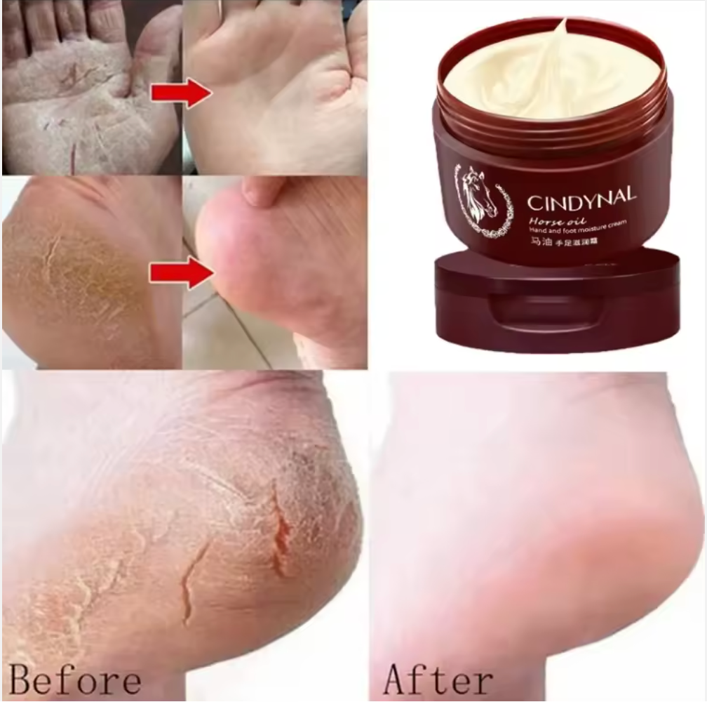 كريم الحرير العلاجي – لترميم وترطيب تشققات الجسم بزيت الحصان