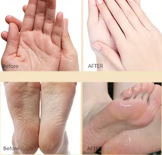 كريم الحرير العلاجي – لترميم وترطيب تشققات الجسم بزيت الحصان